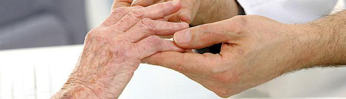 блуждающий артрит симптомы и лечение