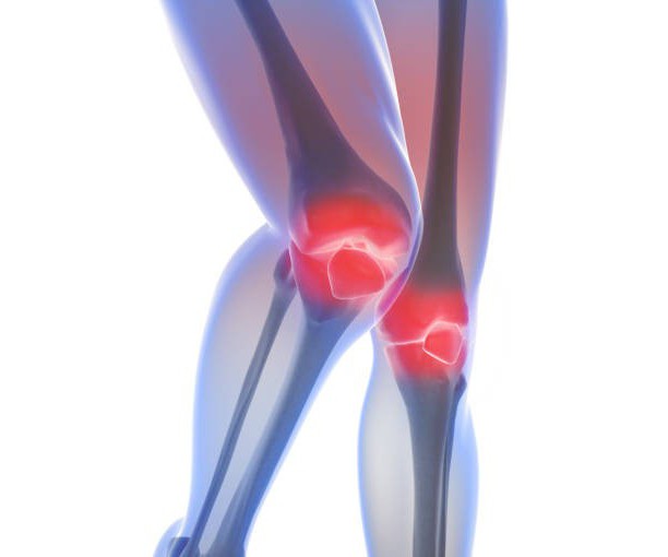 Отечность колена при артрите thumbnail
