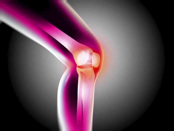 Что такое артрит или артроз когда болят суставы thumbnail