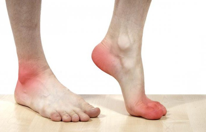 воспаление стопы ноги симптомы и лечение