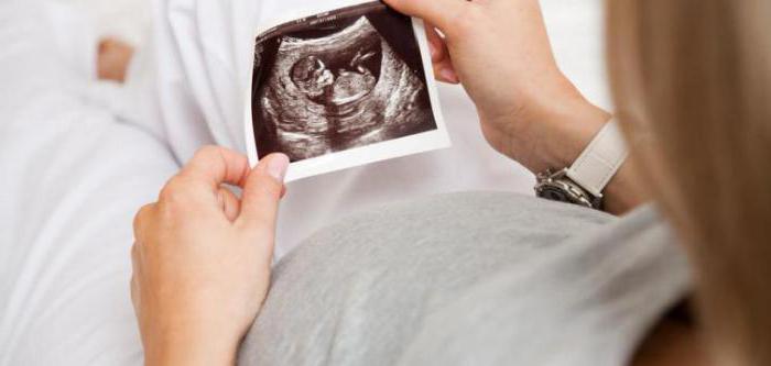 Ретроамниотическая гематома при беременности что это такое thumbnail