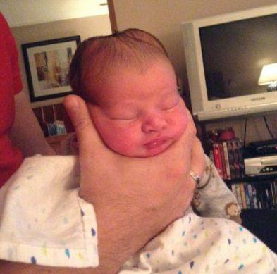 У новорожденного ребенка гематома на голове что делать thumbnail