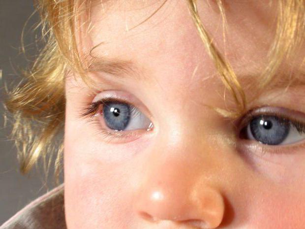 Воспаление сетчатки глаза у детей thumbnail