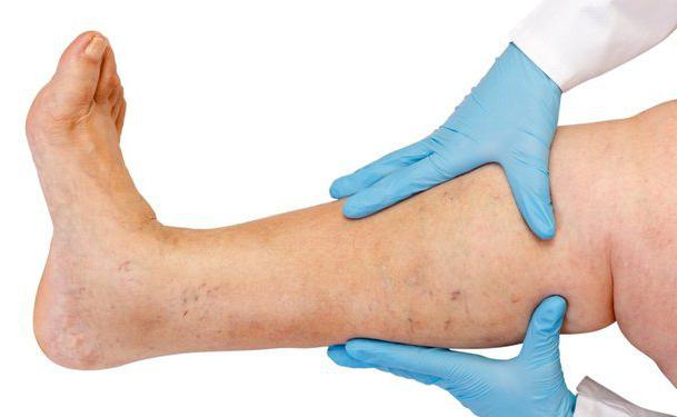 Лечение ран при диабете на ногах раны и их лечение thumbnail