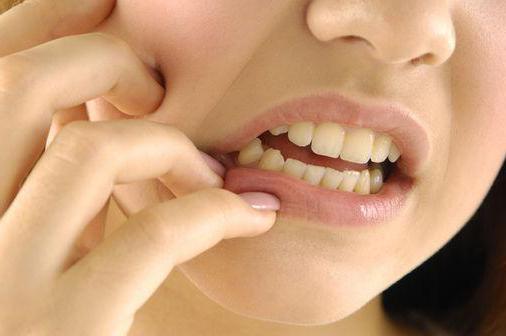 удаление зуба с гранулемой осложнения