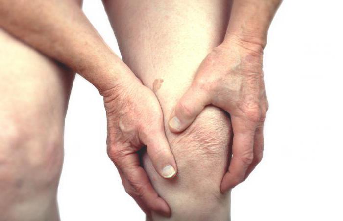 Лечение ревматоидного артрита препараты народные средства thumbnail