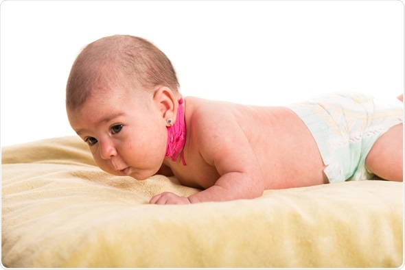 Синдром мышечной дистонии у новорожденных фото thumbnail
