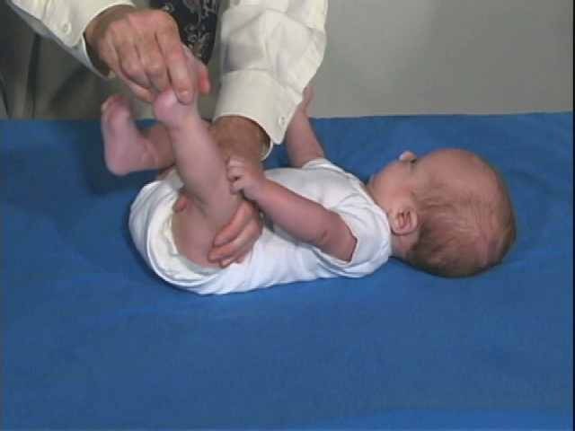 Синдром мышечной дистонии у ребенка 3 месяца thumbnail