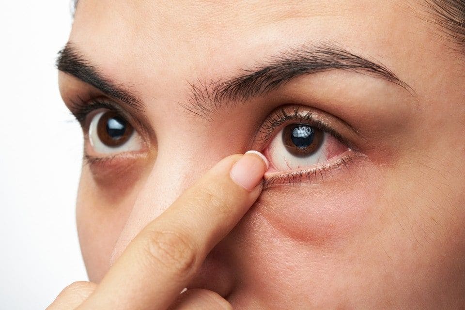 Аллергия в уголках глаз что делать thumbnail