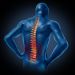 Диагностика и лечение болей в спине