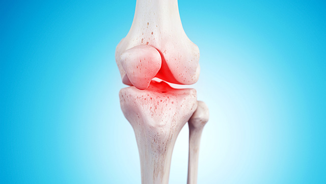 Чем лечить отеки ног при болезнях суставов thumbnail
