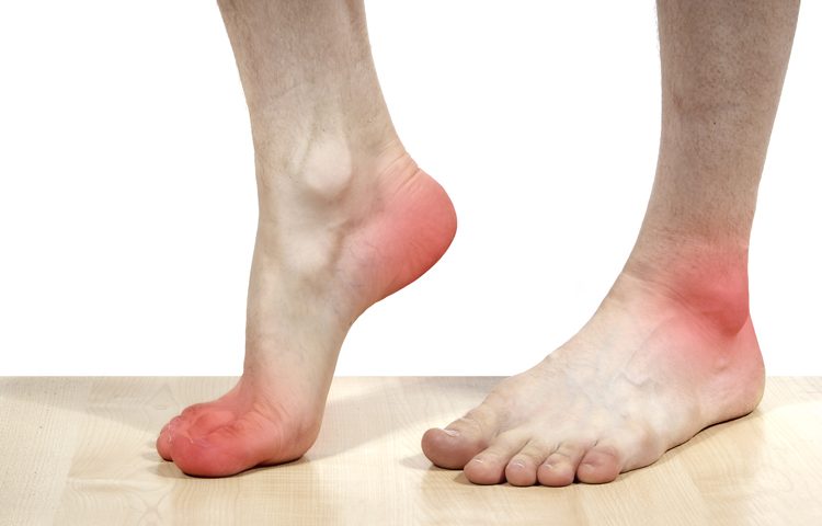 Болят ступни ног причина к какому врачу thumbnail