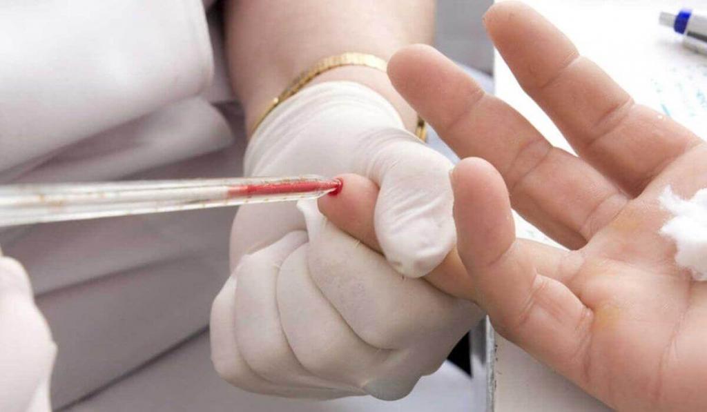 Как определить заболевания крови по общему анализу крови thumbnail