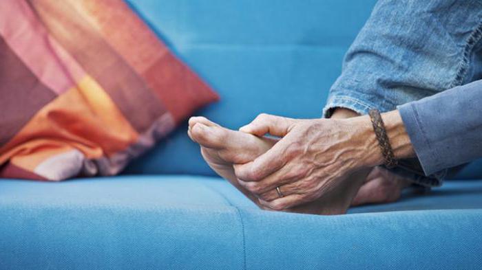 артрит суставов пальцев ног