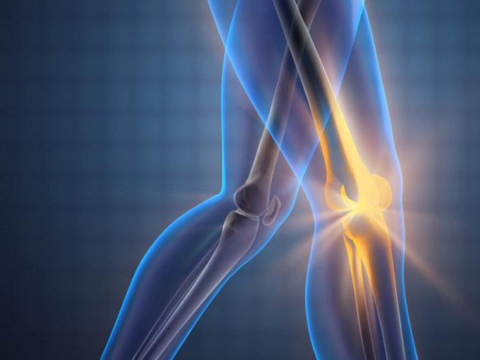 артрит артроз коленного сустава