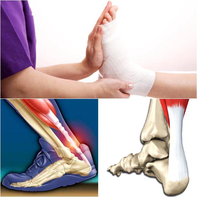 посттравматический артрит коленного сустава лечение