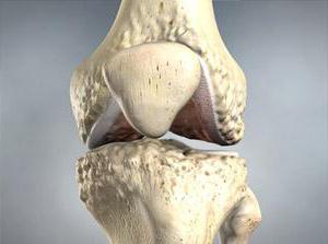 лечение артрита коленного сустава