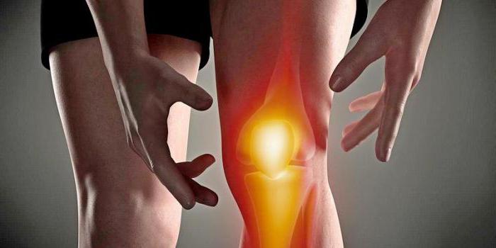 артрит гнойный коленного сустава