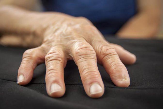 артрит суставов пальцев рук лечение