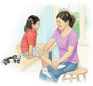 реактивный артрит симптомы и лечение у детей
