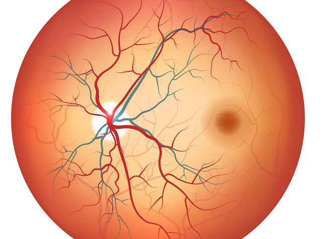 ангиопатия сетчатки обоих глаз что это такое 