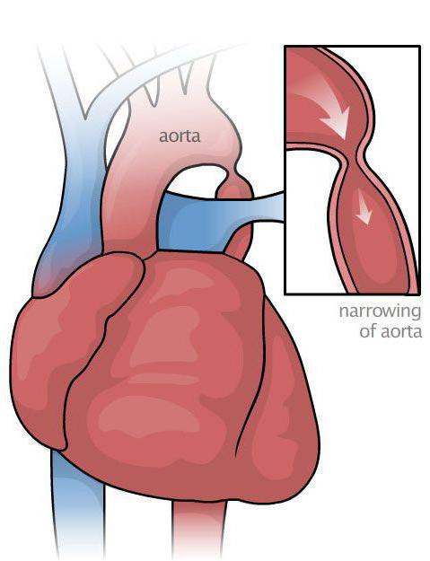 гемодинамические артериальные гипертензии лечение