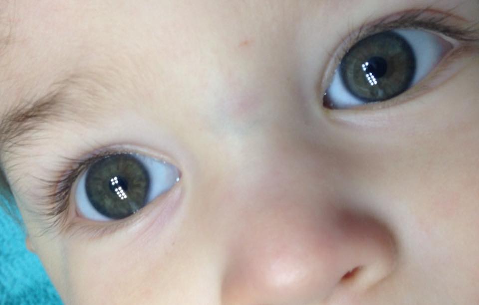 Может ли у ребенка поменяться. Брушфильда пятна брушфильда. Гетерохромия у новорожденных. Глаза новорожденного. Серо голубые глаза у младенца.