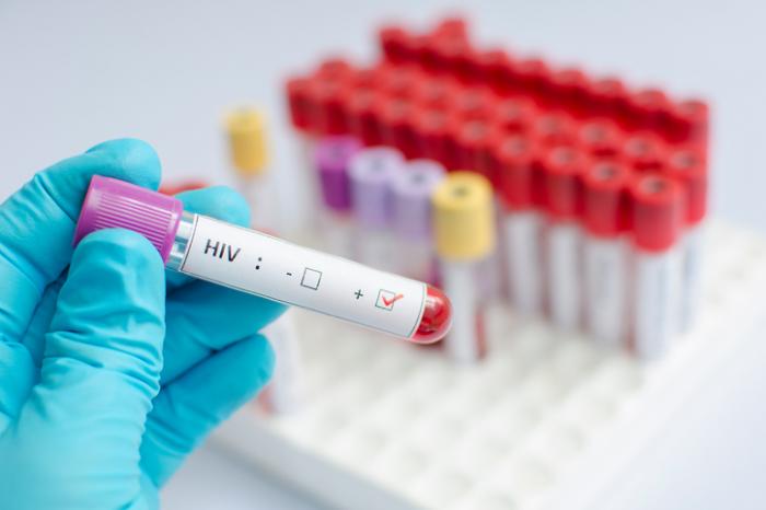 Чем отличается ВИЧ и СПИД?