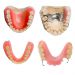 Какой материал лучше для протезирования зубов