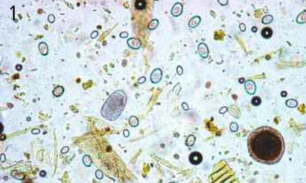 Анализ кала под микроскопом