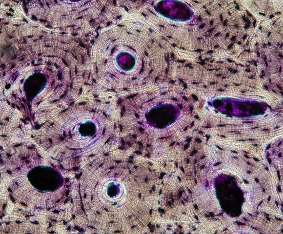 Клеточные образования в костной ткани